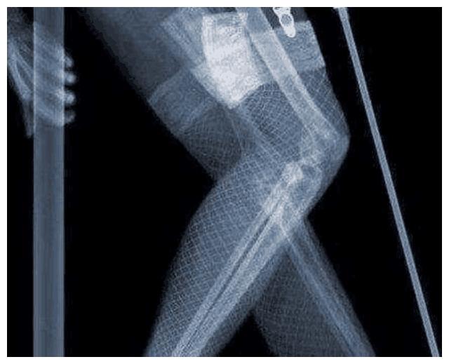 第3836章 杀戮的剑光(求月票):AG亚娱集团(图1) AG亚娱集团官方